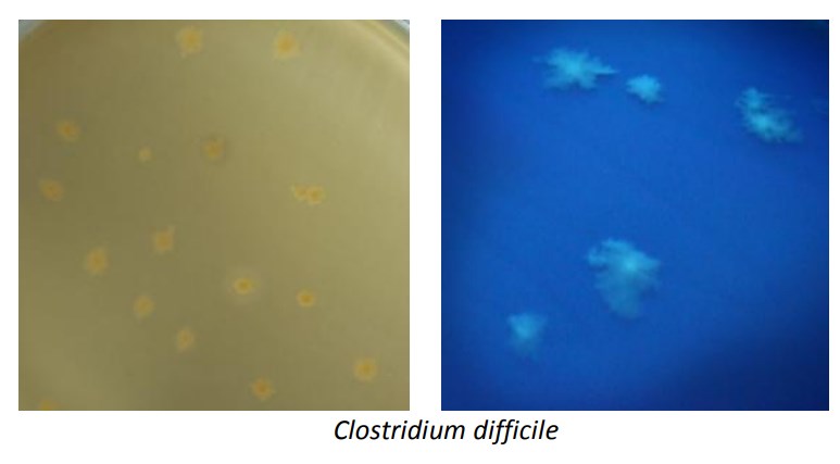 Clostridium Difficile Agar CCEY (Brazie's) Bioprepare